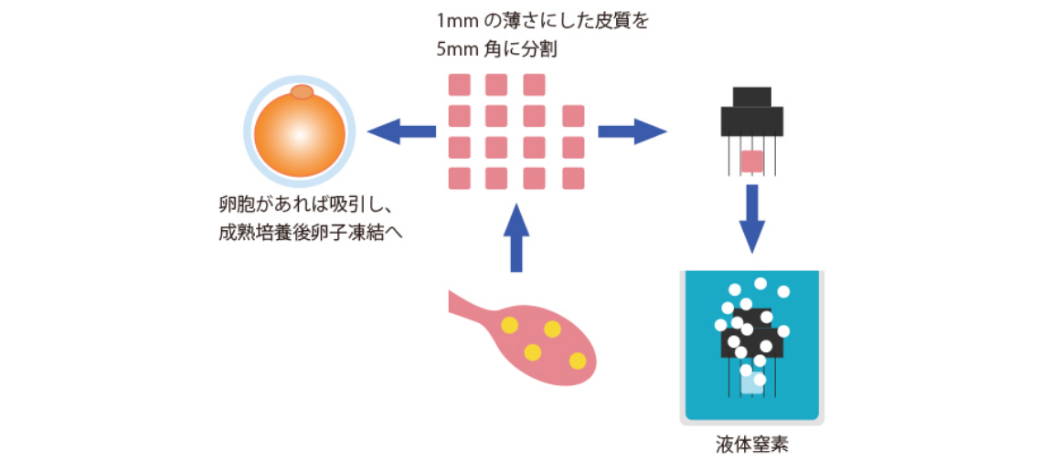 妊孕性温存療法