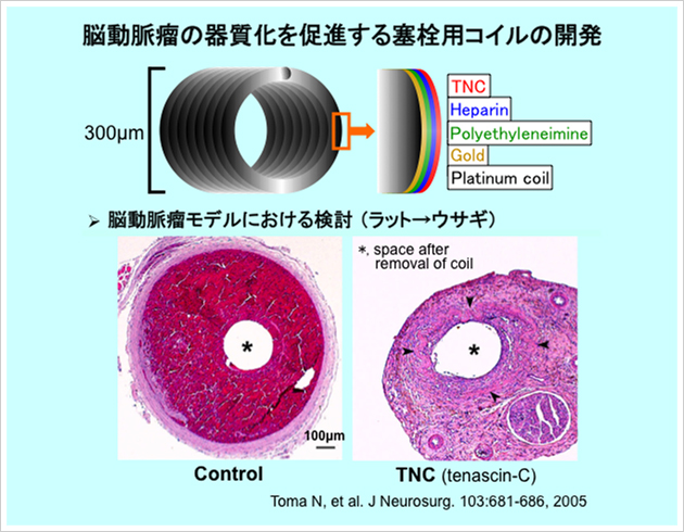 脳動脈瘤の器質化を促進する寒栓用コイルの開発